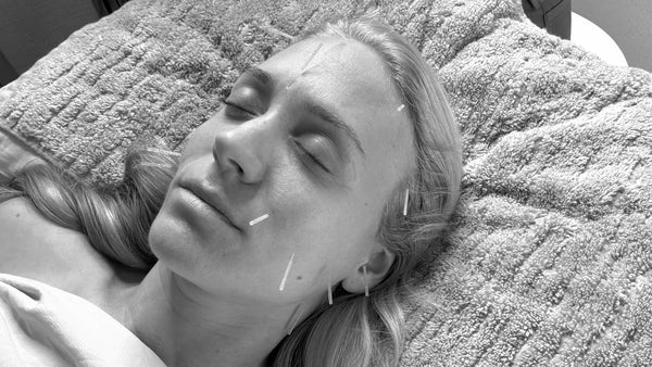 The Elevate Cosmetic Acupuncture Package
